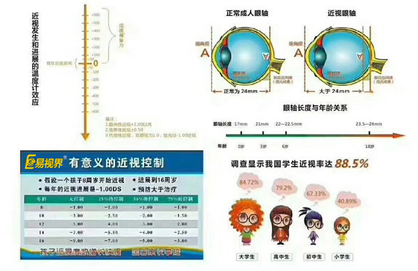 近视的治疗和控制非常重要【易视界视力防控中心】