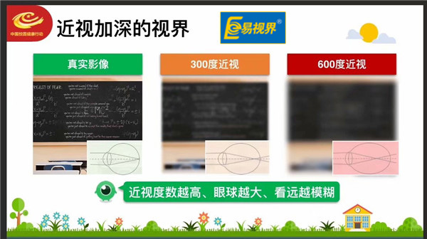 易视界爱眼分享 如何延缓和控制近视度数的增长