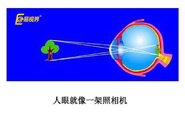 关于近视哪些事 易视界