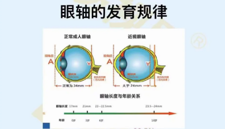 眼轴的发育规律