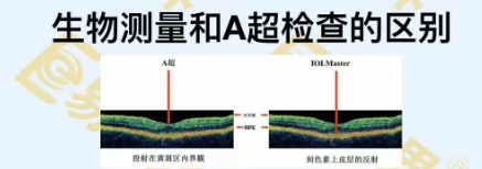 生物测量和A超检查的区别