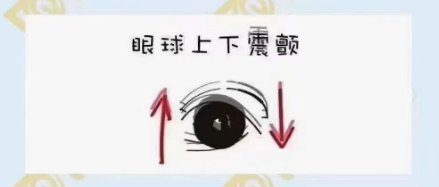 什么是眼球震颤？