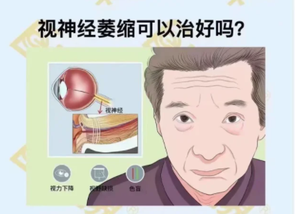 视神经萎缩可以治好吗