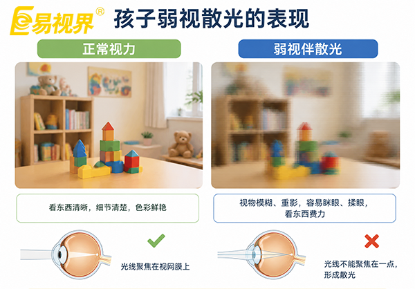 孩子弱视散光是什么原因造成的？易视界视光中心